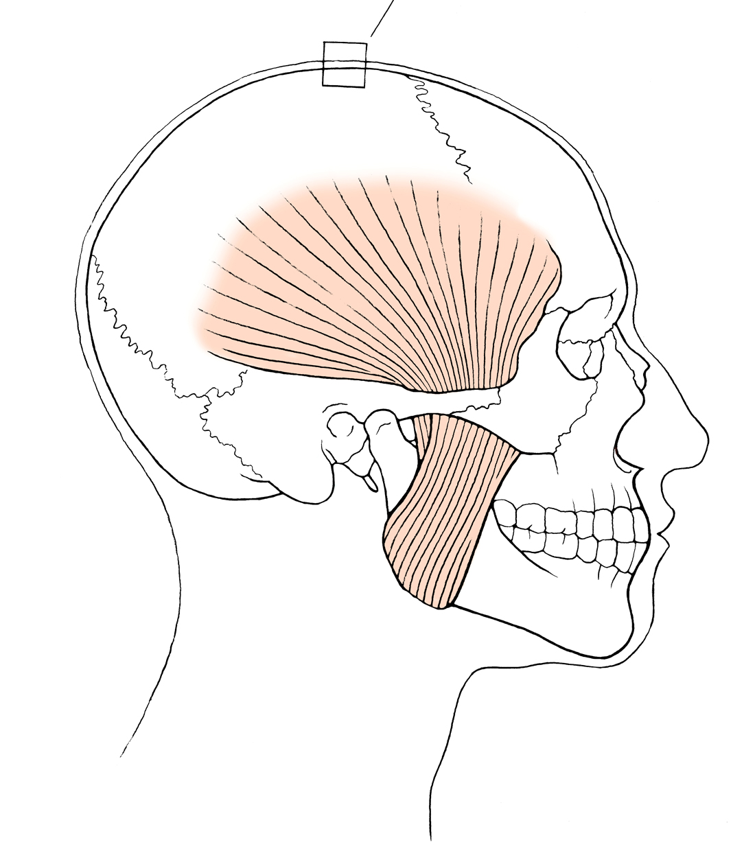 Illustration about pain in the head